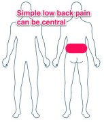 central back pain