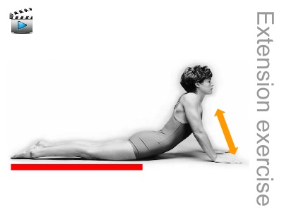 McKenzie_extension-exercise