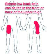 simple low back pain referral